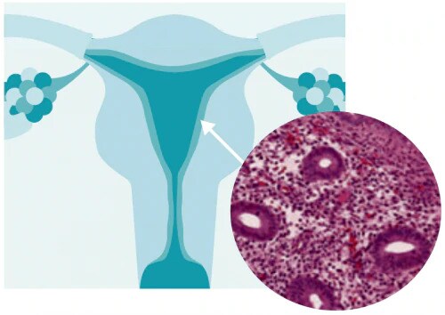 histological-classification-slider-1a