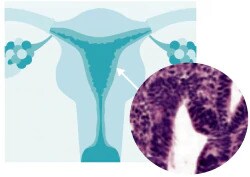 histological-classification-slider-1b