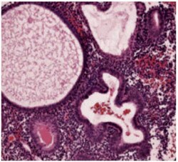 histological-classification-slider-3