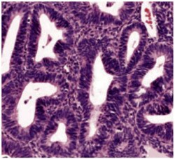 histological-classification-slider-4