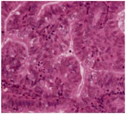histological-classification-slider-5
