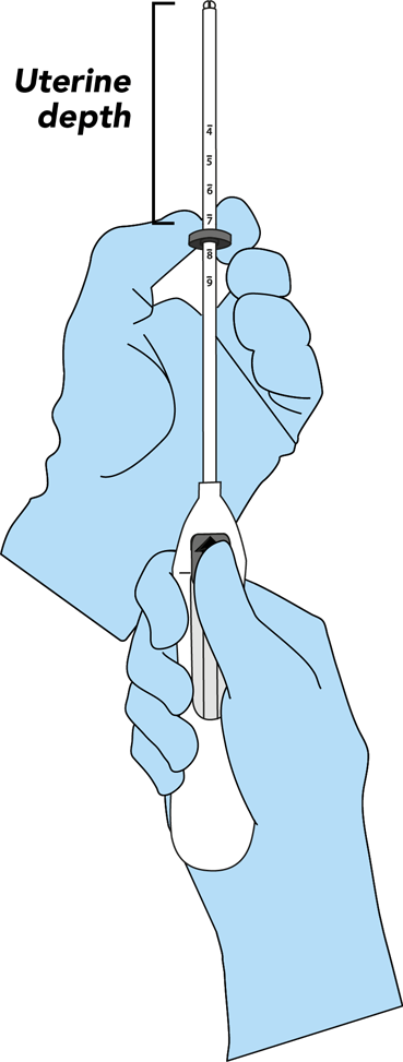 Visual of setting the flange