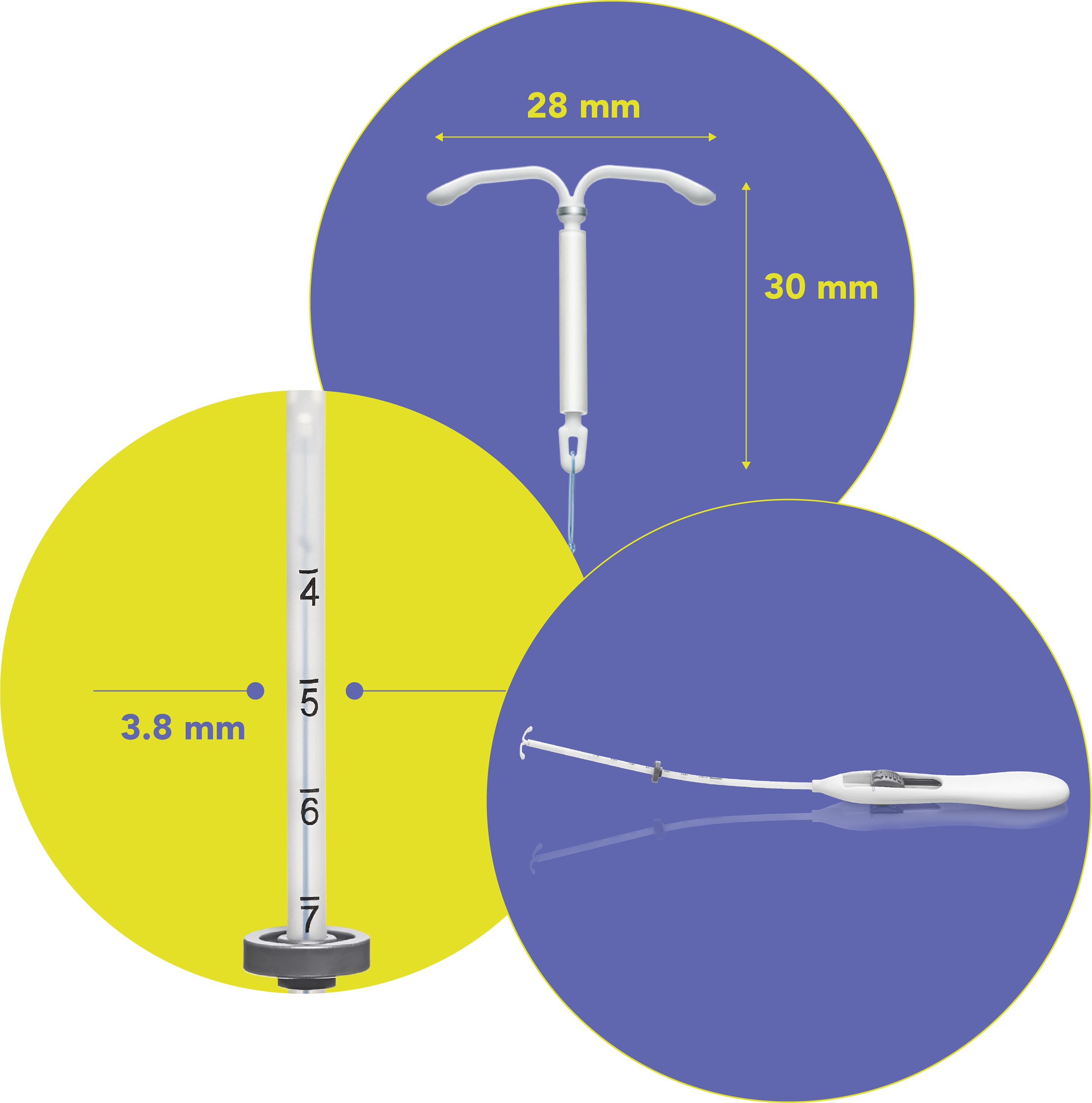 Kyleena Satisfaction Study